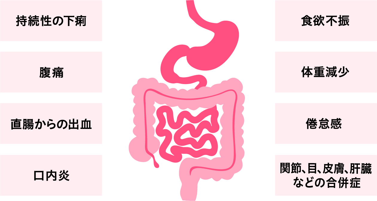 図：クローン病の症状